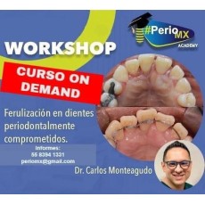 Ferulizacion en dientes periodontales comprometidos $USD